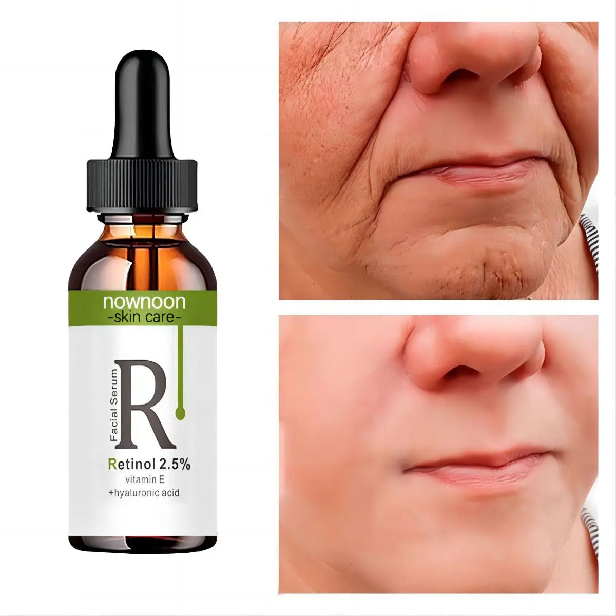 Retinol Anti Wrinkle Serum